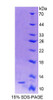 Human Recombinant S100 Calcium Binding Protein A4 (S100A4)