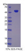 Rat Recombinant O-6-Methylguanine DNA Methyltransferase (MGMT)