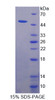 Human Recombinant Phospholipase B (PLB)