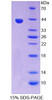 Rat Recombinant VEGF Co Regulated Chemokine 1 (VCC1)