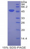 Mouse Recombinant Laminin Gamma 2 (LAMC2)