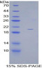 Human Recombinant Growth Differentiation Factor 10 (GDF10)