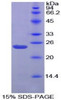 Chicken Recombinant Gremlin 1 (GREM1)