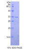 Human Recombinant Axis Inhibition Protein 2 (AXIN2)