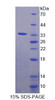 Human Recombinant Filamin A Alpha (FLNa)