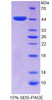 Rat Recombinant E1A Binding Protein P300 (EP300)