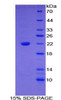 Mouse Recombinant Bleomycin Hydrolase (BLMH)