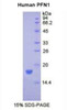 Human Recombinant Profilin 1 (PFN1)