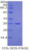 Human Recombinant Nucleolin (NCL)