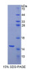 Human Recombinant Acylphosphatase 1, Erythrocyte (ACYP1)