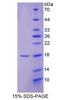 Rat Recombinant Allograft Inflammatory Factor 1 (AIF1)