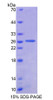 Human Recombinant Ancient Ubiquitous Protein 1 (AUP1)