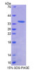 Human Recombinant Antizyme Inhibitor 1 (AZIN1)