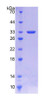 Human Recombinant Antithrombin (AT)