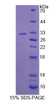 Mouse Recombinant Bcl6 Corepressor (BCOR)