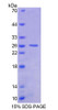 Human Recombinant Basonuclin 1 (BNC1)