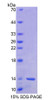 Human Recombinant Barrier To Autointegration Factor 1 (BANF1)