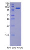 Human Recombinant Lipase, Bile Salt Dependent (BSDL)