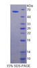 Human Recombinant Corneodesmosin (CDSN)