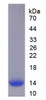 Human Recombinant Chorionic Gonadotropin Beta Polypeptide 1 (CGb1)