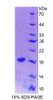 Human Recombinant Cellular Retinoic Acid Binding Protein 1 (CRABP1)