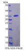 Human Recombinant Carnitine Acetyltransferase (CRAT)