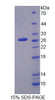 Rat Recombinant Cytoglobin (CYGB)