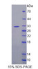 Mouse Recombinant Exonuclease 1 (EXO1)