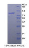 Human Recombinant Fatty Acid Synthase (FASN)