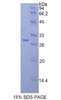 Mouse Recombinant Fatty Acid Synthase (FASN)