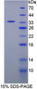 Cattle Recombinant Fibrinogen Gamma (FGg)