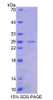 Human Recombinant Friend Leukemia Virus Integration 1 (FLI1)