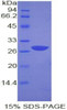 Human Recombinant Growth Factor Receptor Bound Protein 2 (Grb2)