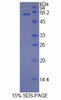 Human Recombinant Histidine Rich Glycoprotein (HRG)