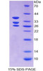 Mouse Recombinant Islet Cell Autoantigen 1 (ICA1)