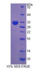 Rat Recombinant Leucine Rich Repeats And Death Domain Containing Protein (LRDD)