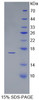 Human Recombinant Luteinizing Hormone Beta Polypeptide (LHb)