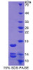 Human Recombinant Urocortin 2 (UCN2)