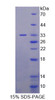 Human Recombinant Ureidopropionase Beta (UPb1)