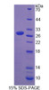 Mouse Recombinant Ureidopropionase Beta (UPb1)