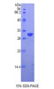 Human Recombinant Vaccinia Related Kinase 1 (VRK1)