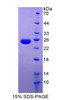 Human Recombinant Vascular Endothelial Growth Inhibitor (VEGI)