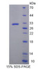 Human Recombinant Zinc Finger Protein 10 (ZNF10)
