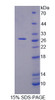 Mouse Recombinant Midline 1 (MID1)