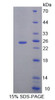 Mouse Recombinant Molybdenum Cofactor Synthesis 1 (MOCS1)