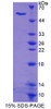 Mouse Recombinant Metastasis Associated Protein 1 (MTA1)