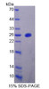 Mouse Recombinant Mitochondrial Tumor Suppressor 1 (MTUS1)