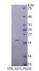 Mouse Recombinant Metaxin 1 (MTX1)