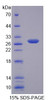 Human Recombinant Myelin Transcription Factor 1 (MYT1)