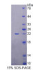 Human Recombinant Myocyte Specific Enhancer Factor 2A (MEF2A)